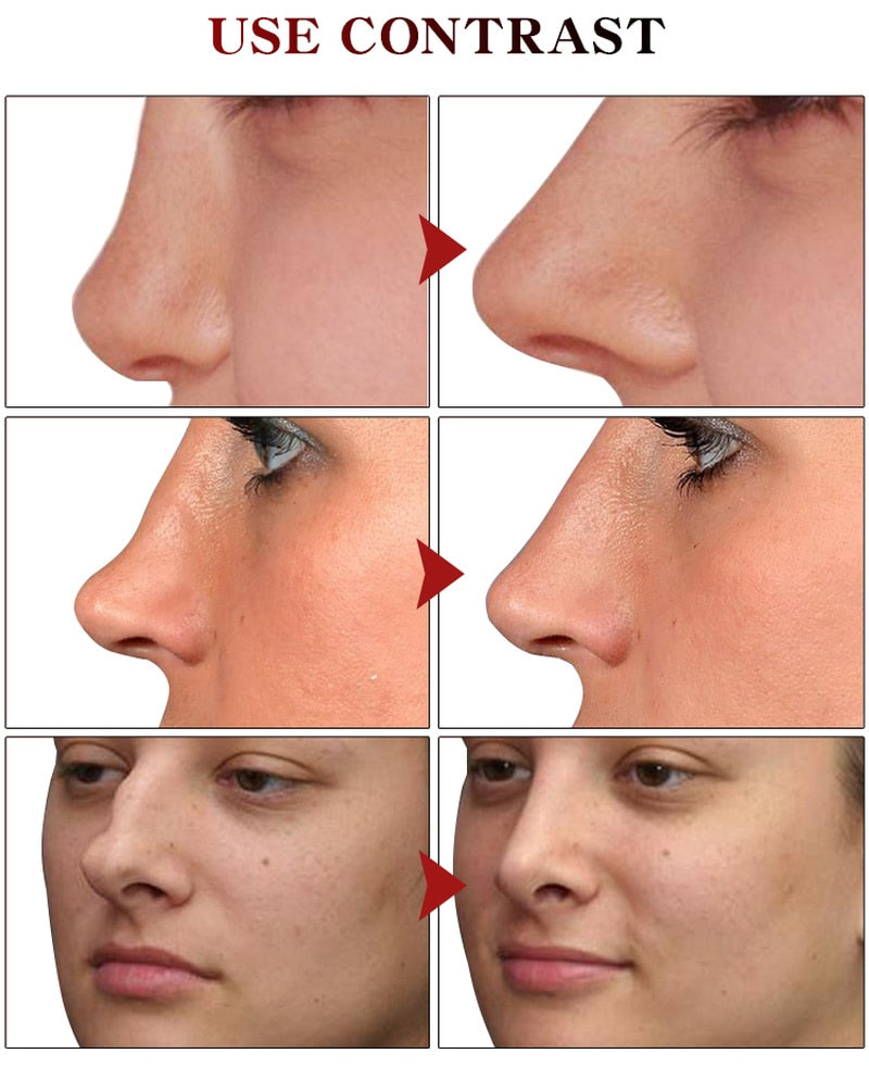 Nose Essential Oil Up Heighten Rhinoplasty Natural Face Care - without any surgery